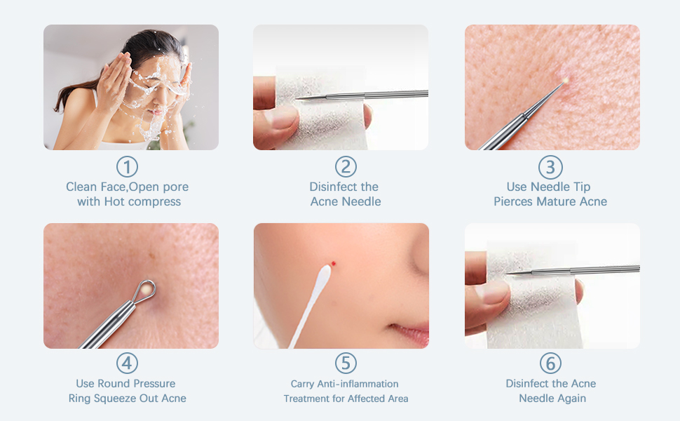 how to use blackhead remover tool